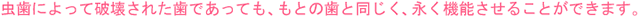 虫歯